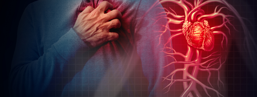 symptoms of heart attack in women